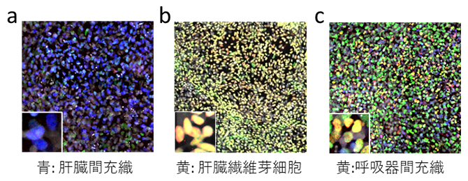 ヒトES細胞から分化した臓器間充織細胞の例の図