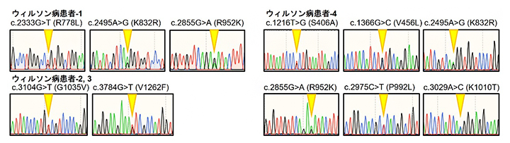 4名のウィルソン病患者から検出されたATP7B遺伝子変異の図