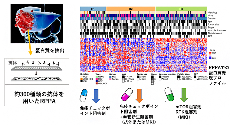 RPPA法による肝臓がんの分子分類と最適治療薬物の選択の図