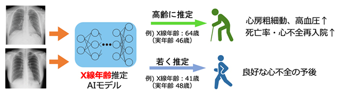 X線年齢の臨床応用のイメージ図