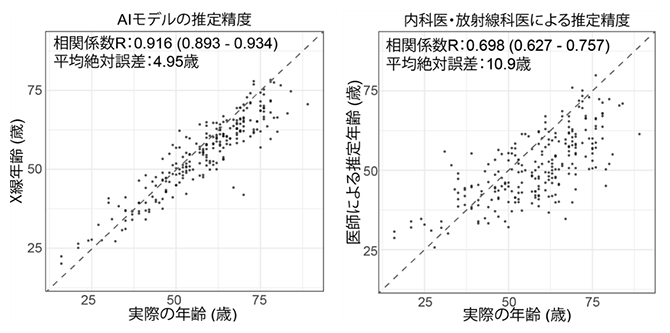 AIモデルによる年齢推定精度（左）と医師による年齢推定精度（右）の図