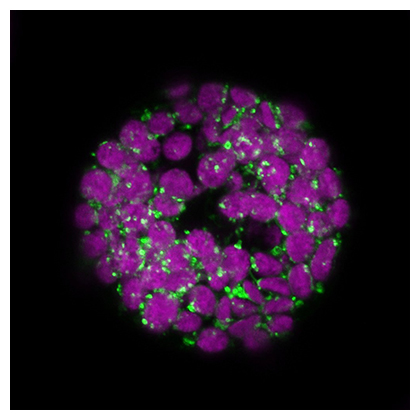 LPPε1（緑色）が葉緑体（紫色）の特定の部位に局在する細胞内の顕微鏡画像の図