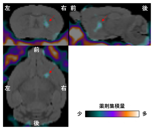 11Cで標識されたエリブリンを用いた脳腫瘍の検出の図