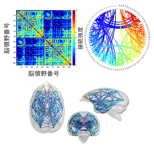 MRIによる脳ネットワーク情報の表現図の画像