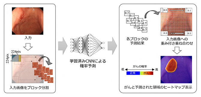 早期胃がんの領域予測のフローの図