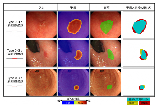 内視鏡検査画像に対する専門医の範囲診断とAIによる領域予測の比較の図