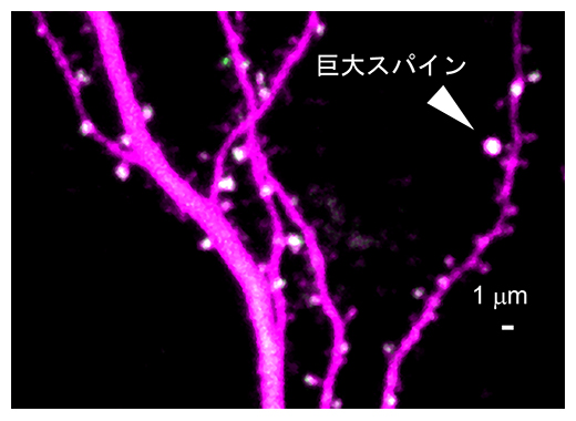 神経細胞の樹状突起に形成された巨大スパインの図
