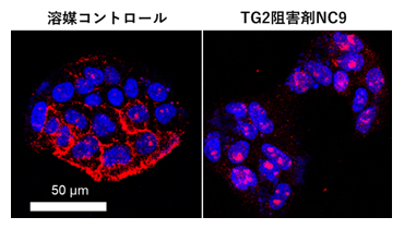 肝がん細胞におけるTG2によるヘパラン硫酸の制御の図