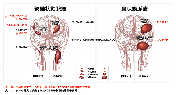 脳動脈瘤の位置とPDGFRβ遺伝子変異の関係の図