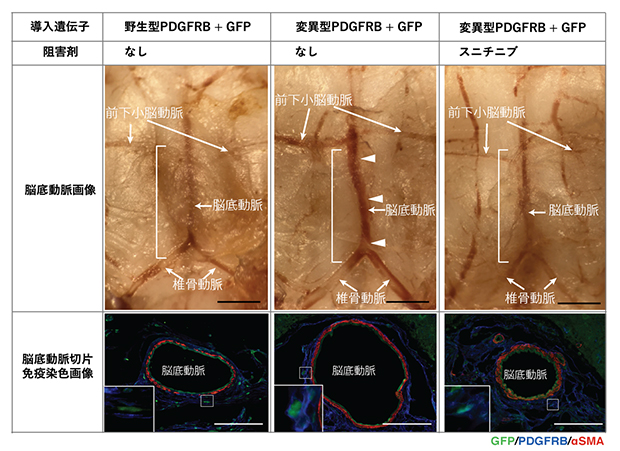 マウス紡錘状動脈瘤モデルでの血管径拡張とスニチニブ投与による動脈瘤化の抑制の図