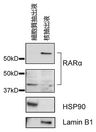 細胞質RARαと核RARαのウエスタンブロット法の結果の図