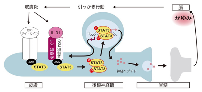 かゆみを伝達する感覚神経細胞におけるSTAT3の役割の図