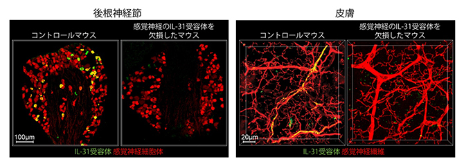 IL-31受容体を発現する感覚神経細胞とそれらが皮膚に伸ばした神経線維の図