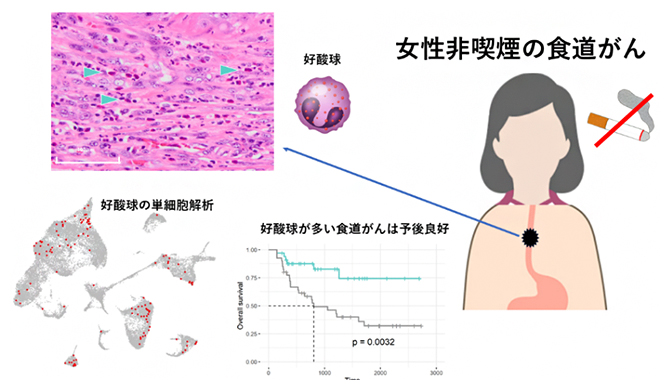 女性非喫煙者の食道がんの特徴の図