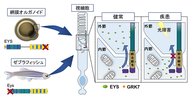 本研究に基づくEYS関連網膜変性疾患の病態の概略図の画像