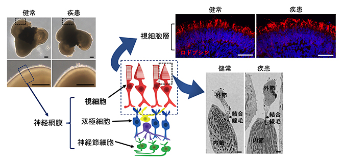 ヒトiPS細胞からの網膜オルガノイドの作製の図