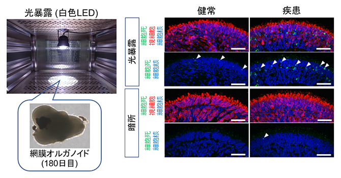 網膜オルガノイドにおける光誘導性の視細胞死評価の図