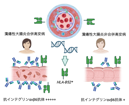 高安病と潰瘍性大腸炎、抗インテグリンαvβ6抗体との関連の図