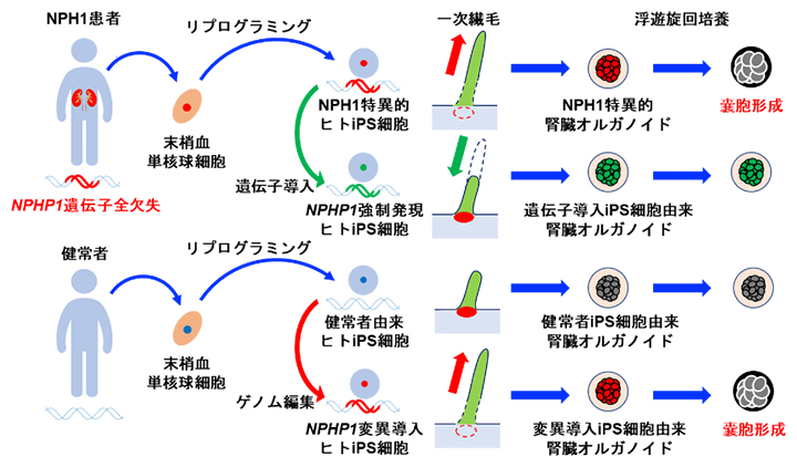 ヒトiPS細胞による若年性ネフロン癆の病態モデリング～遺伝性腎臓病発症の仕組みの解明へ～