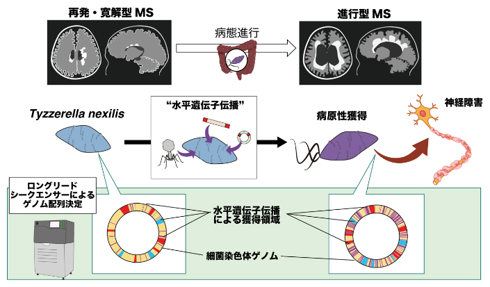 多発性硬化症の難治化に関連する”異型”腸内細菌株の発見～遺伝子伝播により獲得された病原性と治療・予防への意義～