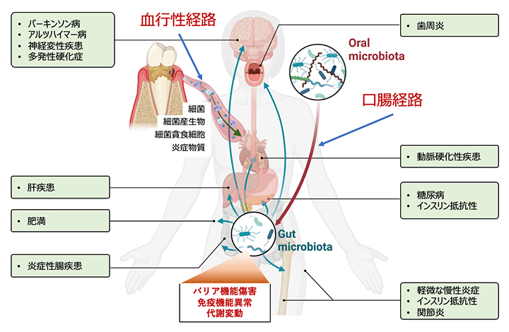 口腔細菌叢の乱れは腸内細菌叢の乱れ～歯周病に罹患すると腸内細菌叢が乱れて全身に悪影響の恐れ～