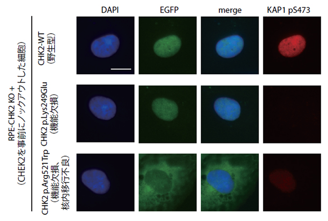 CHEK2ミスセンスバリアントに対する機能解析における細胞実験結果の図
