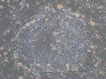 ヒトES細胞（KhES-1）の写真