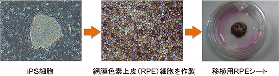 iPS細胞由来網膜色素上皮(RPE)シートの作製と品質管理のフローチャート図