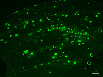 Image of the brain of mouse model with fluorescent staining Image of the brain of mouse model with fluorescent staining
