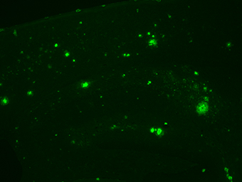 Image of the stained amyloid-beta peptide in the brain