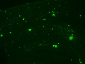 Image of the stained amyloid-beta peptide in the brain Image of the stained amyloid-beta peptide in the brain