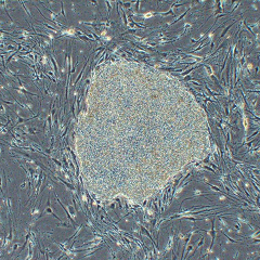 Image of iPS cell