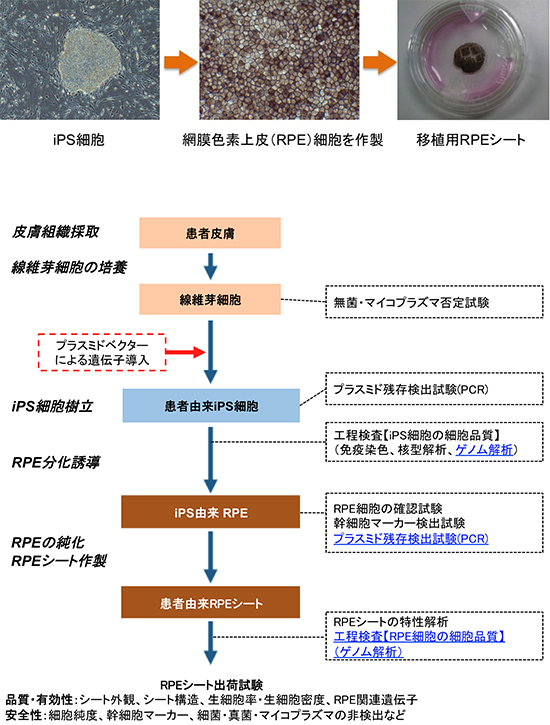 iPS細胞由来網膜色素上皮(RPE)シートの作製と品質管理のフローチャート図