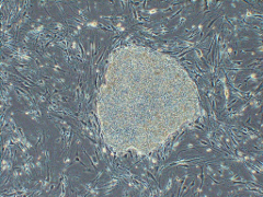 Microscopic image of an iPS cell