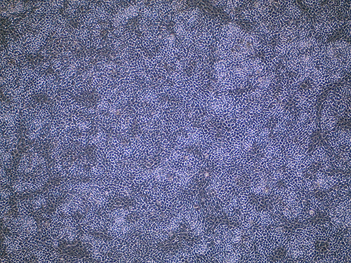 他家iPS細胞由来網膜色素上皮細胞（RPE細胞）の画像