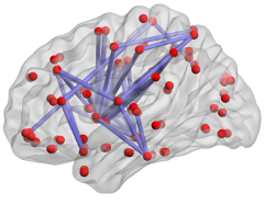 Brain with neural network