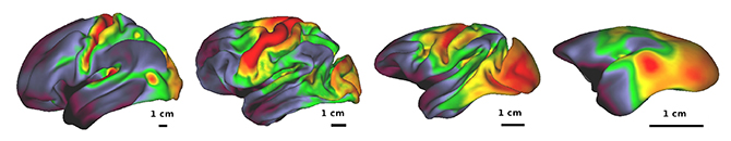 MRIで撮像した脳地図の例の画像