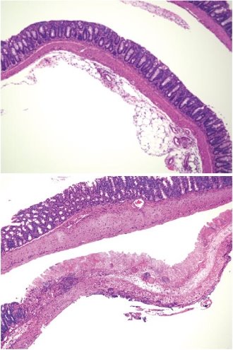 Image of colon inflammation in mice