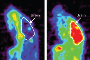 PET image of mouse brain