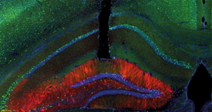 Image of a mouse brain 