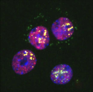 Image of corpus luteal cells 