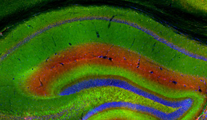 Image of hippocampus