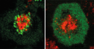 Image of B cells
