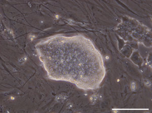 Image of rat ES cells