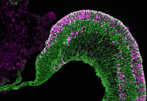 Image of eye cells