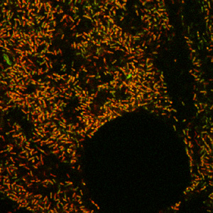 Image of endosymbiotic spirochetes