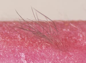 Image of hair from mouse stem cells 