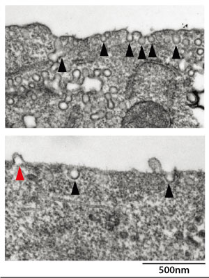 Microscopic images of normal and deficient cells