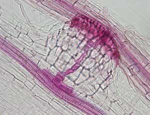 Microscopic image of haustorium
