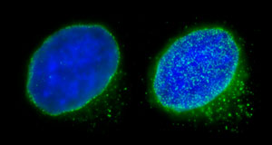 Image of nuclear pore complexes